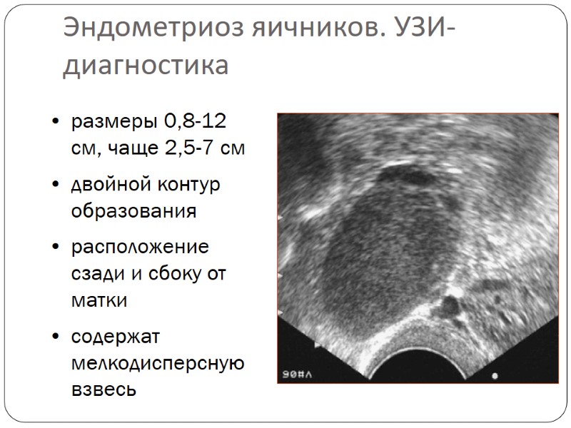 размеры 0,8-12 см, чаще 2,5-7 см  двойной контур образования  расположение сзади и